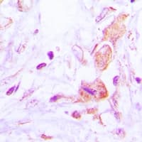 Polyclonal Rabbit anti-Human GBF1 Antibody (IHC, WB)