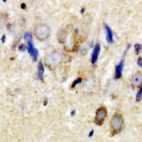 Polyclonal Rabbit anti-Human GPM6A / Glycoprotein M6A Antibody (IHC, WB)