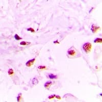 Polyclonal Rabbit anti-Human HIST3H3 Antibody (IHC, WB)