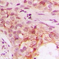 Polyclonal Rabbit anti-Human Prohibitin 2 / PHB2 Antibody (IHC, WB)