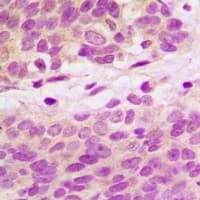 Polyclonal Rabbit anti-Human PIK3C2A Antibody (IHC, WB)