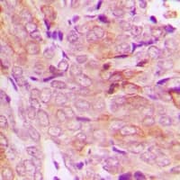 Polyclonal Rabbit anti-Human RAB1B Antibody (IHC, WB)