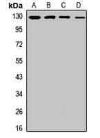 Polyclonal Rabbit anti-Human ITGAL / CD11a Antibody (WB)