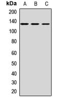 Polyclonal Rabbit anti-Human CD163 Antibody (WB)