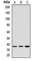 Polyclonal Rabbit anti-Human CLEC10A / CD301 Antibody (WB)