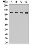 Polyclonal Rabbit anti-Human CORIN Antibody (WB)