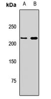 Polyclonal Rabbit anti-Human DICER1 / Dicer Antibody (WB)