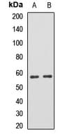 Polyclonal Rabbit anti-Human FGB / Fibrinogen Beta Chain Antibody (WB)