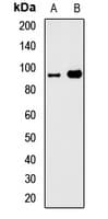 Polyclonal Rabbit anti-Human GTF3C4 Antibody (WB)