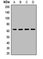 Polyclonal Rabbit anti-Human HP / Haptoglobin Antibody (WB)