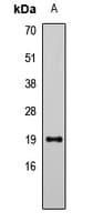 Polyclonal Rabbit anti-Human LCN1 / Lipocalin-1 Antibody (WB)