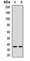 Polyclonal Rabbit anti-Human LYVE1 Antibody (WB)
