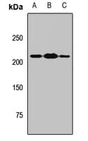 Polyclonal Rabbit anti-Human MYT1 Antibody (WB)