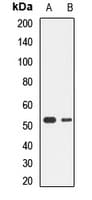 Polyclonal Rabbit anti-Human NRF1 / NRF-1 Antibody (WB)