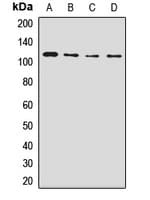 Polyclonal Rabbit anti-Human NUP98 Antibody (WB)