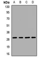 Polyclonal Rabbit anti-Human PGAM1 Antibody (WB)