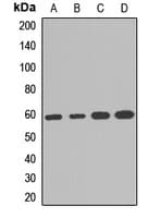 Polyclonal Rabbit anti-Human PHGDH Antibody (WB)