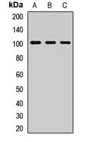 Polyclonal Rabbit anti-Human PIDD1 Antibody (WB)