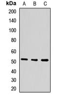 Polyclonal Rabbit anti-Human PPARA / PPAR Alpha Antibody (WB)