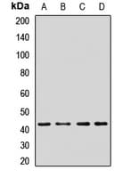 Polyclonal Rabbit anti-Human PRKAR2A Antibody (WB)