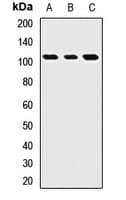 Polyclonal Rabbit anti-Human ROBO4 Antibody (WB)