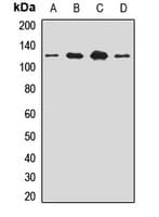 SART1 Antibody