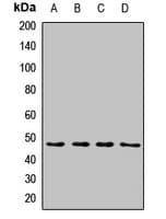 Polyclonal Rabbit anti-Human PACSIN3 Antibody (WB)