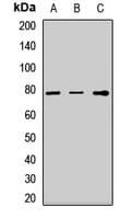 Polyclonal Rabbit anti-Human TGFBI Antibody (WB)