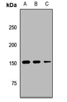 Polyclonal Rabbit anti-Human UTY Antibody (WB)