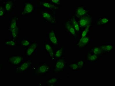 Polyclonal Rabbit anti-Human UTY Antibody (IF)