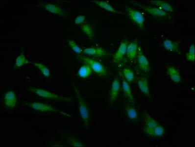 Polyclonal Rabbit anti-Human PRCP Antibody (IF)