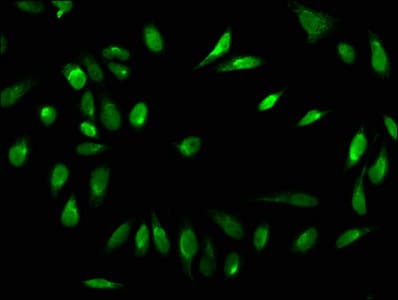 Polyclonal Rabbit anti-Human HIST1H1C Antibody (IF)