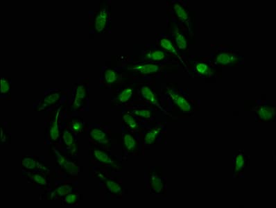 Polyclonal Rabbit anti-Human HIST1H1C Antibody (IF)