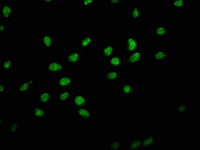 HIST1H1E Antibody