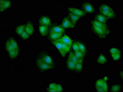 Polyclonal Rabbit anti-Human CRYAA / Alpha A Crystallin Antibody (IF)