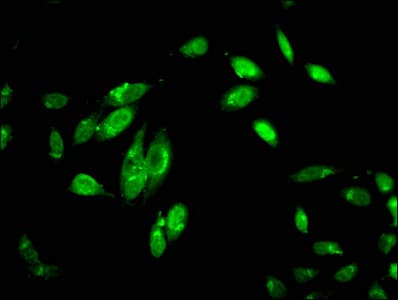 Polyclonal Rabbit anti-Human Complement C1R Antibody (IHC, IF, WB)