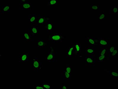Polyclonal Rabbit anti-Human HIST1H1C Antibody (IF)