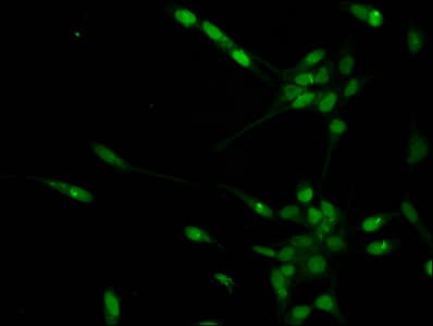 Polyclonal Rabbit anti-Human HIST1H1E Antibody (IF)