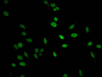 HIST1H1E Antibody