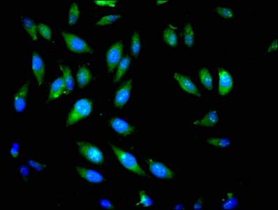 Polyclonal Rabbit anti-Human PIK3CB / PI3K Beta Antibody (IF)