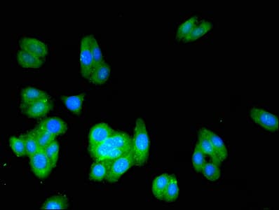ACMSD Antibody