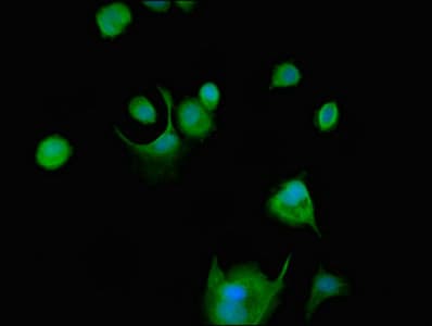 SRMS Antibody