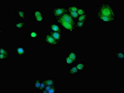 Polyclonal Rabbit anti-Human ADK / Adenosine Kinase Antibody (IHC, IF, WB)