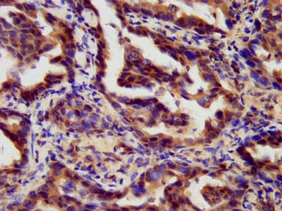 Polyclonal Rabbit anti-Human RARG / RAR-Gamma Antibody (IHC, WB)