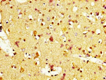 Polyclonal Rabbit anti-Human MC1R Antibody (IHC, WB)