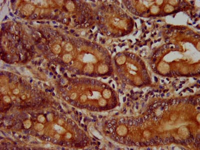 Polyclonal Rabbit anti-Human CCS Antibody (IHC)