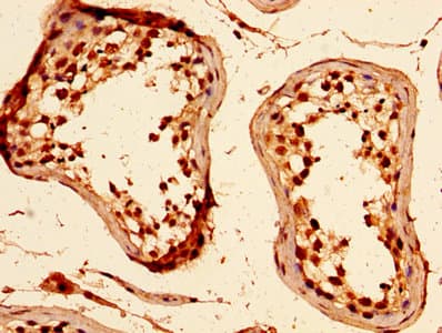 Polyclonal Rabbit anti-Human HIST1H1C Antibody (IHC)