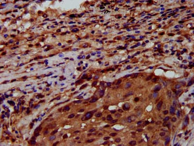 RNF43 Antibody