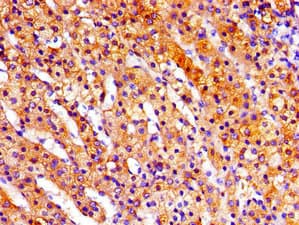 Polyclonal Rabbit anti-Human RPS6KA3 / RSK2 Antibody (IHC, WB)