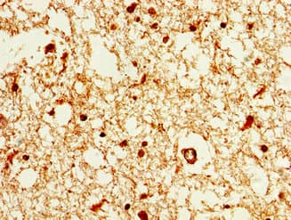 Polyclonal Rabbit anti-Human HIST1H1E Antibody (IHC)